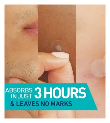 CeraVe Blemish Barrier Patches, image 3